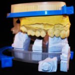 dental articulators