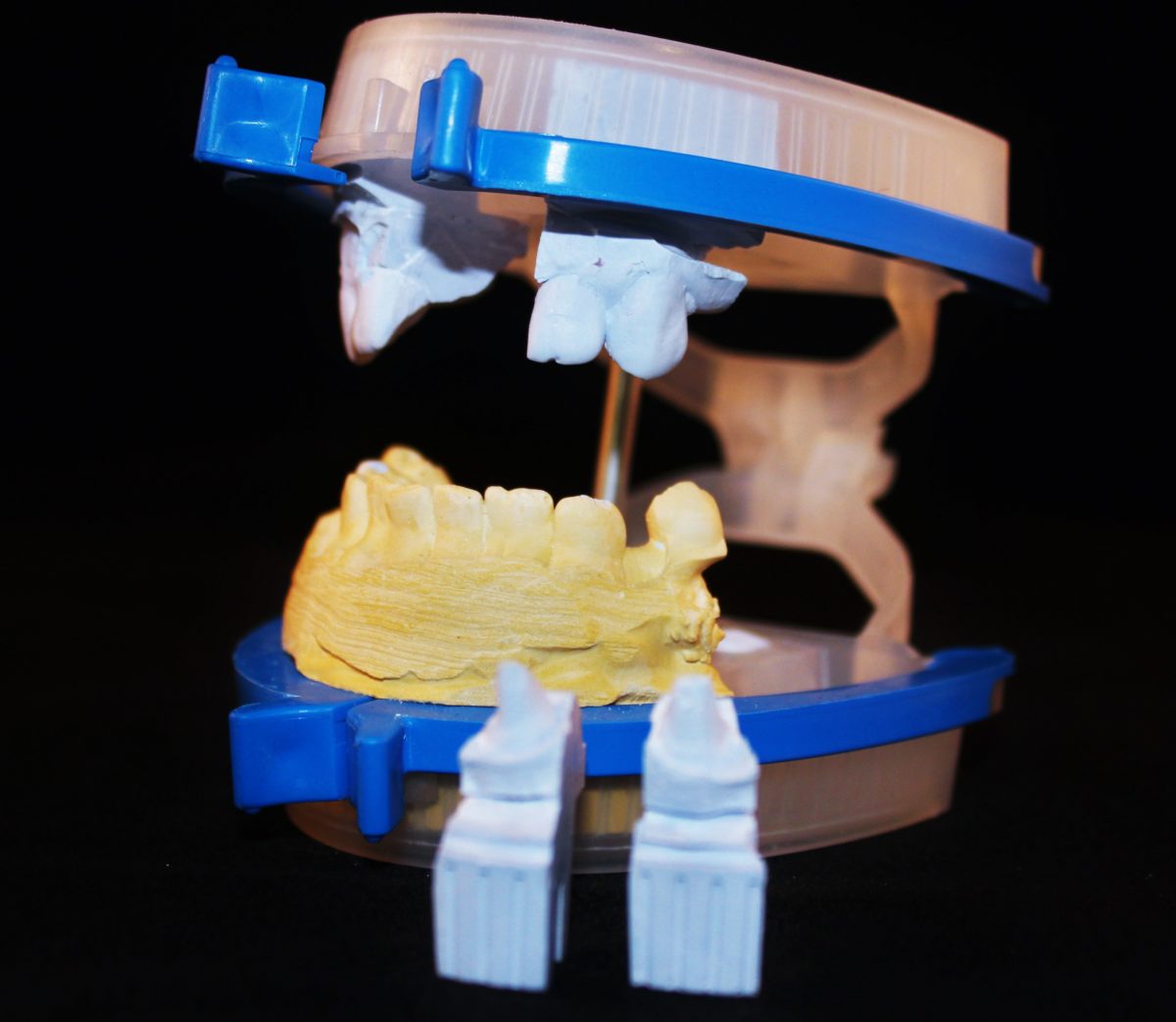 Gallery - Elident - Dental Articulators