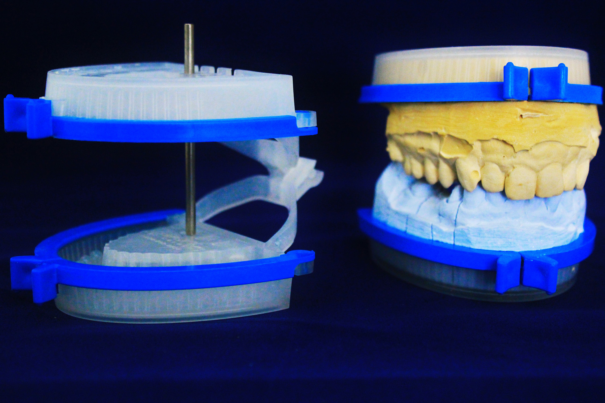 Gallery - Elident - Dental Articulators